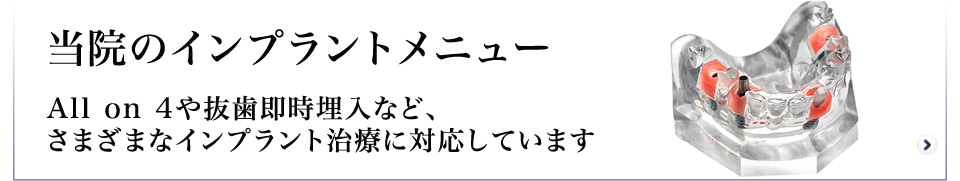 インプラント